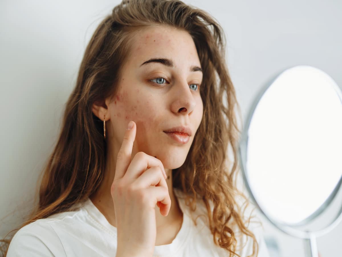 Young woman with problem skin looking into mirror. Dermatology | ANEU Med Spa in Madison, WI