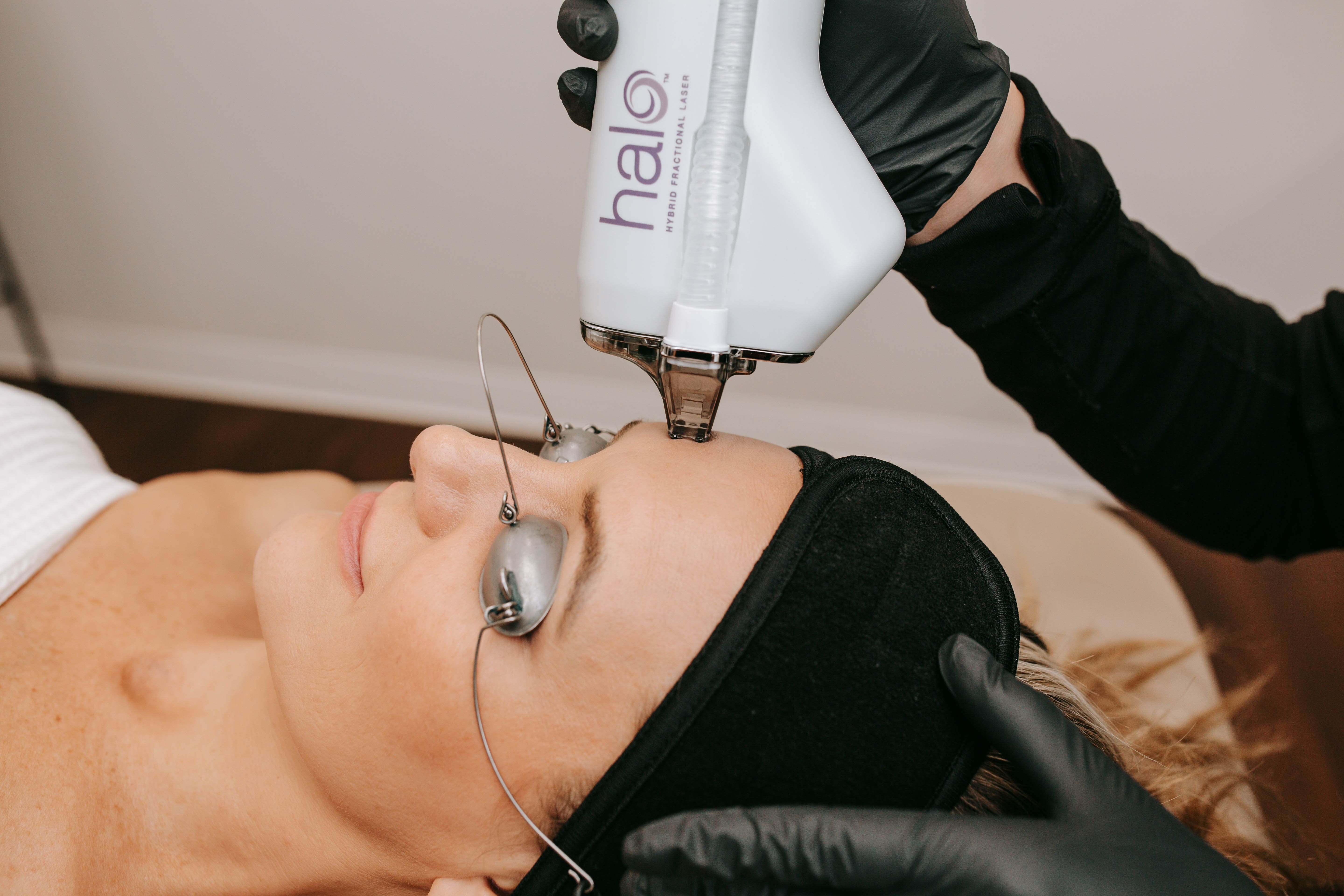 HALO laser | ANEU Medical Spa, LLC | Madison | McFarland, WI