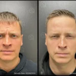 Before and after | forehead wrinkles | ANEU Medical Spa | McFarland | Madison, FL
