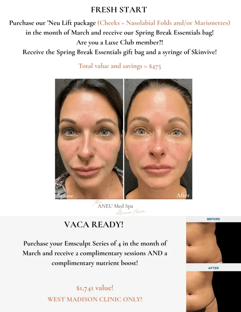 Nasolabial Folds Before and After | ANEU Medical Spa | Madison | McFarland, WI