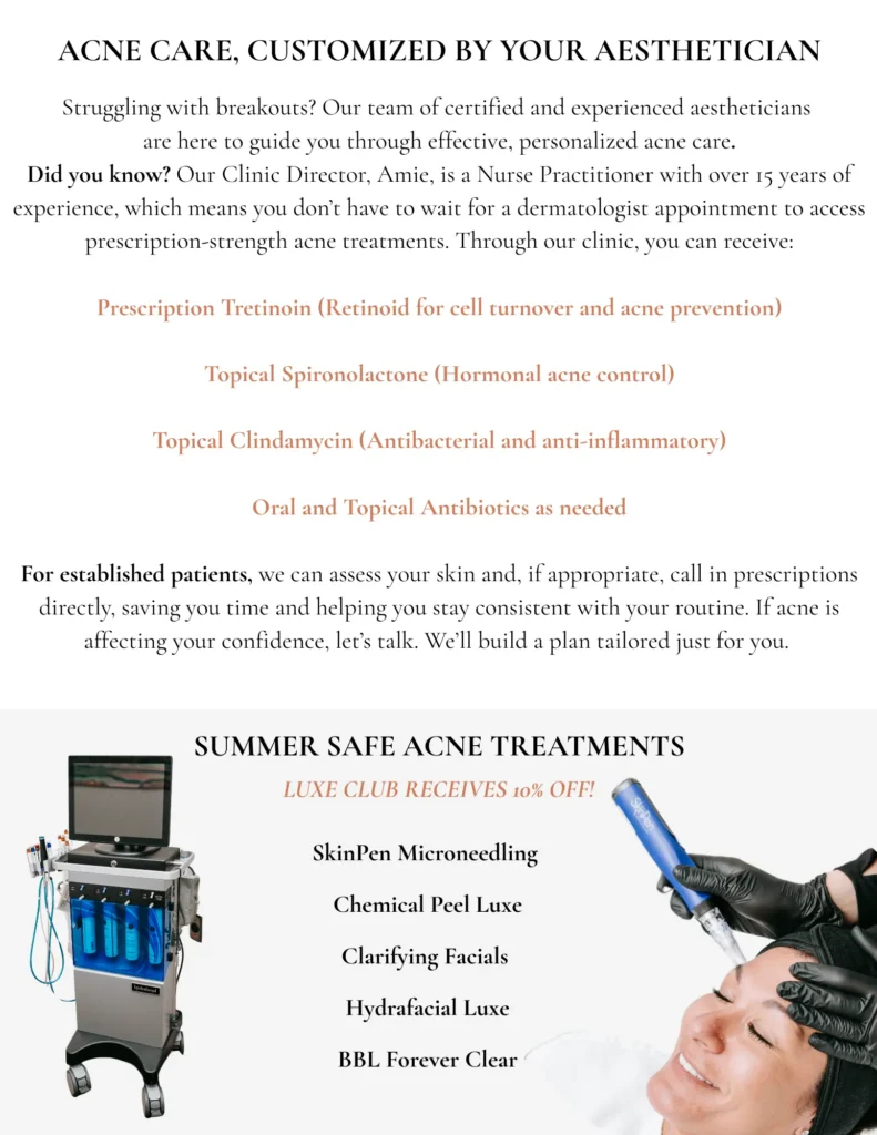 summer safe acne treatments