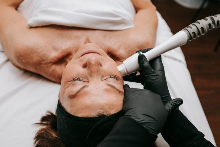 RADIOFREQUENCY MICRONEEDLING | ANEU Medical Spa, LLC | Madison | McFarland, WI