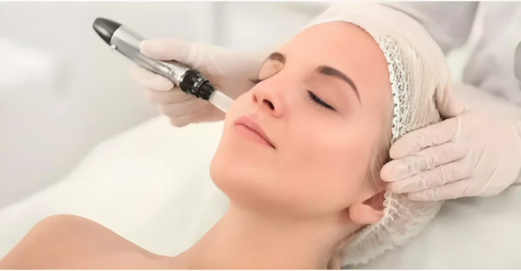 a woman getting a Microneedling treatment | ANEU Medical Spa | McFarland | Madison, FL