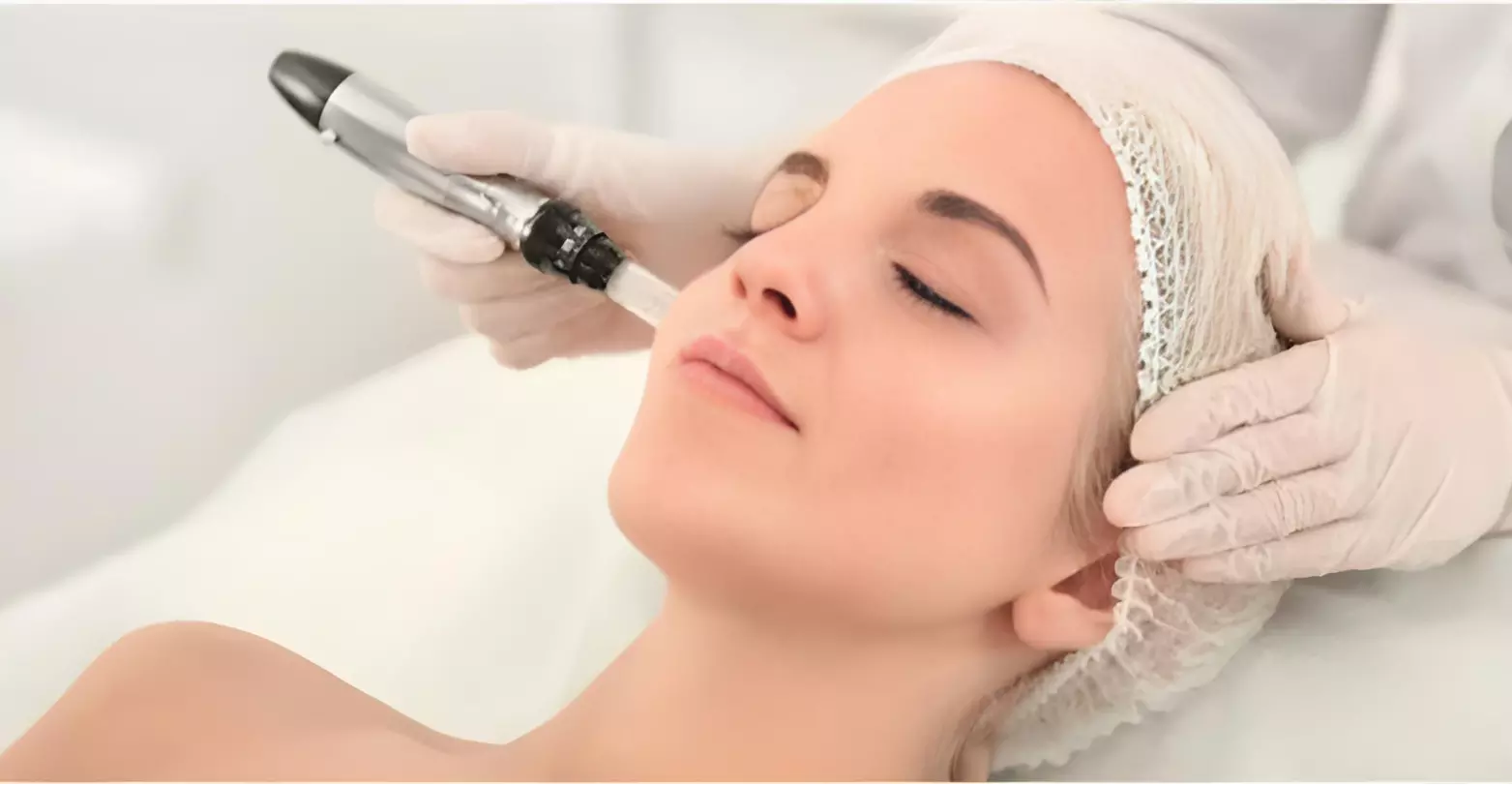 a woman getting a Microneedling treatment | ANEU Medical Spa | McFarland | Madison, FL