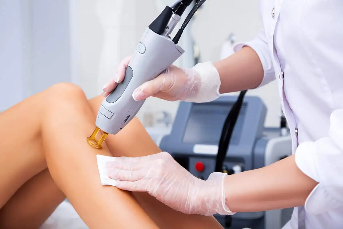 Laser Hair Removal treatment by ANEU Medical Spa in McFarland WI | Madison, WI