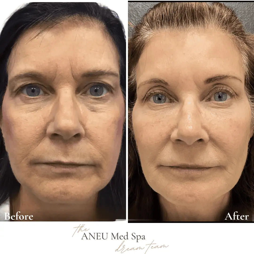 Before and After Transformation Gallery (1)