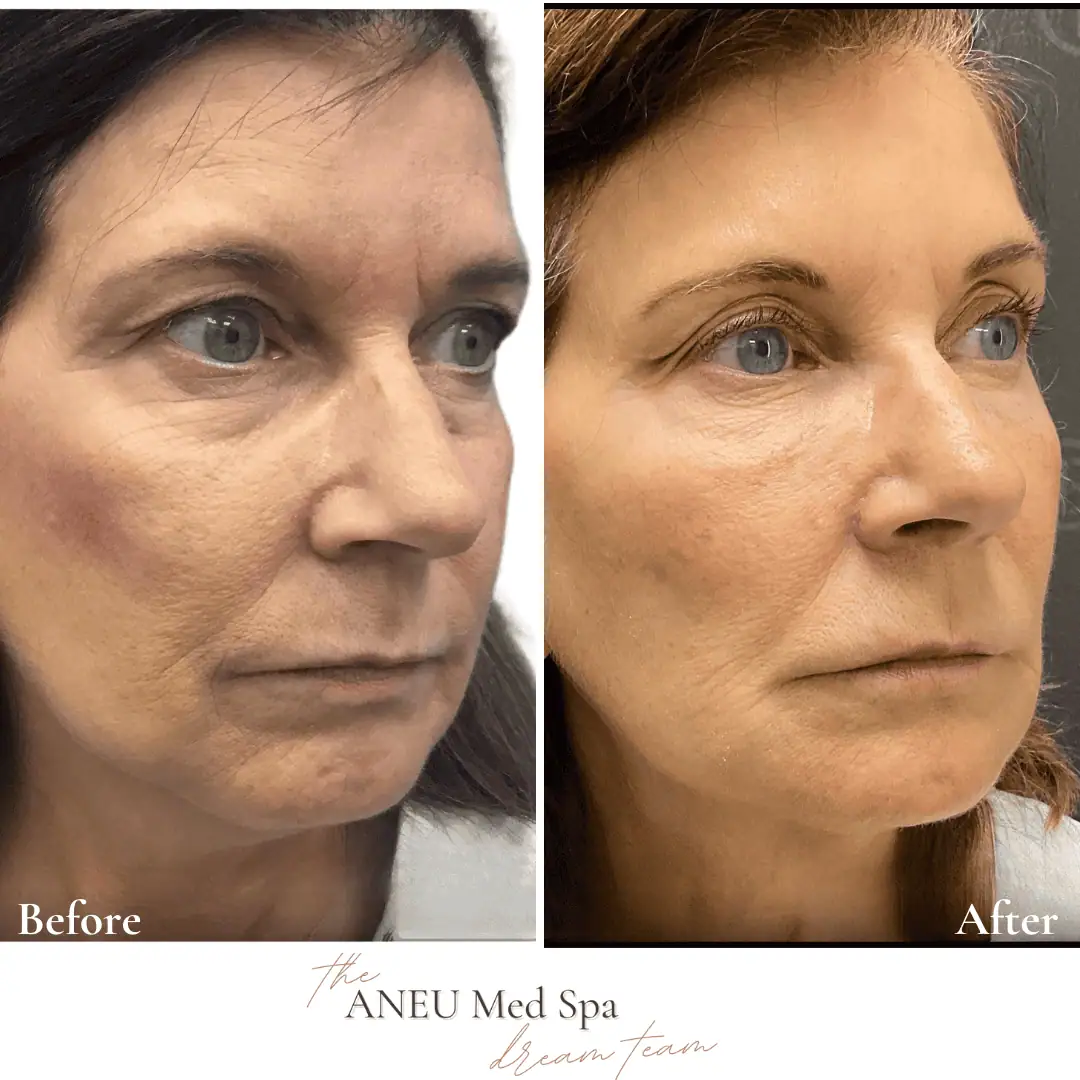 Before and After Transformation Gallery (2)