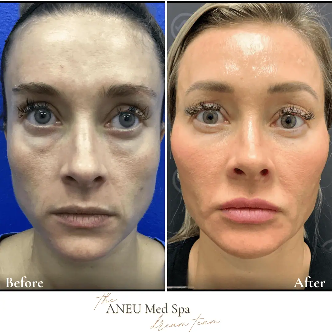 Before and After Transformation Gallery (3)