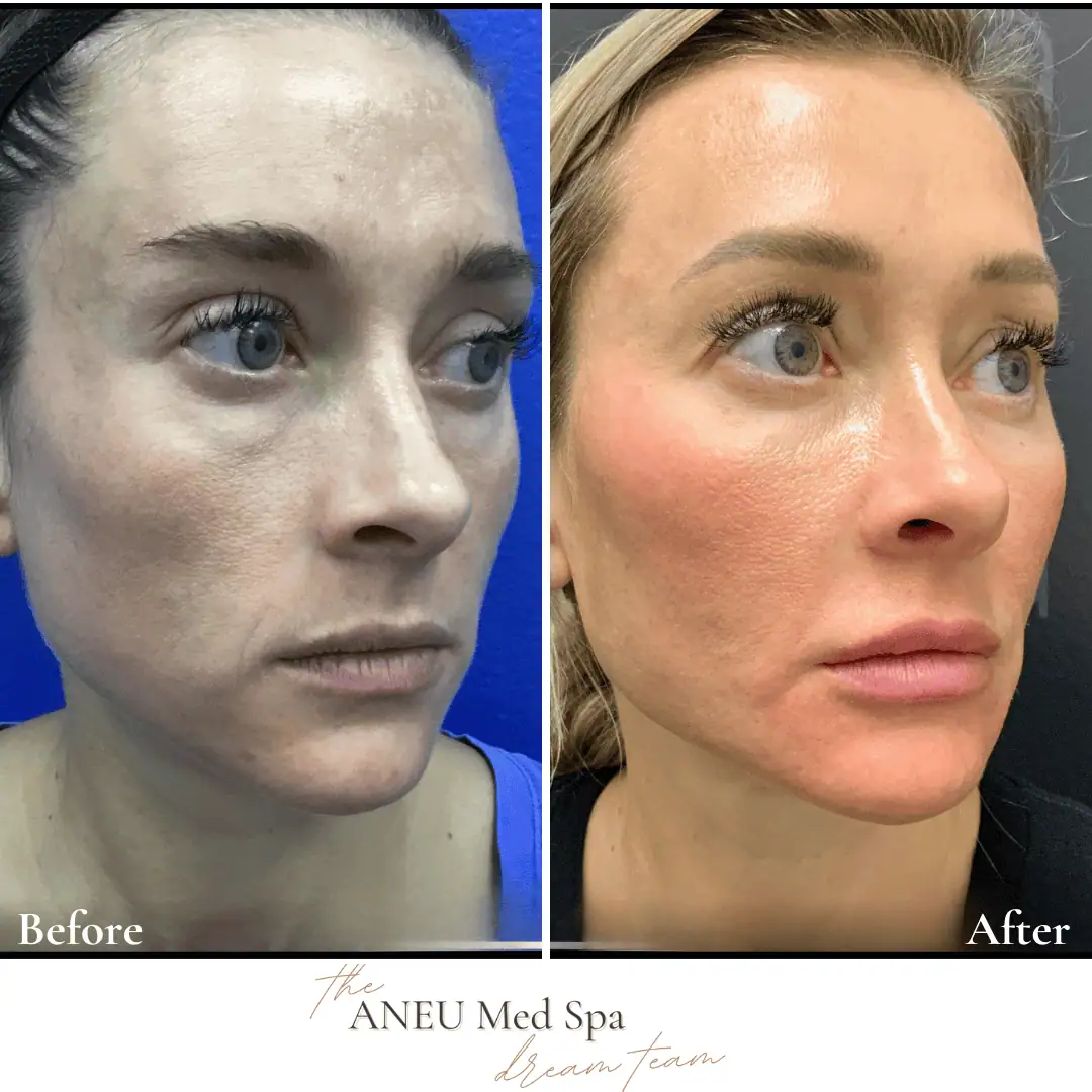 Before and After Transformation Gallery (4)