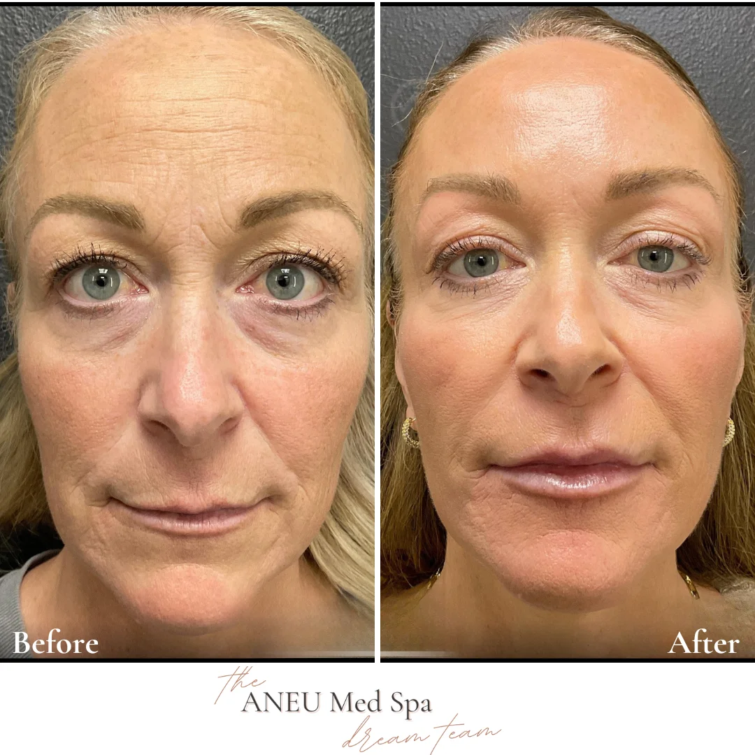 Total-transformation-aneumedspa