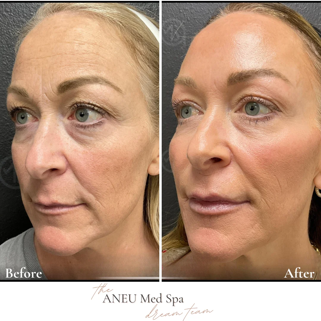 Total-transformation-aneumedspa1